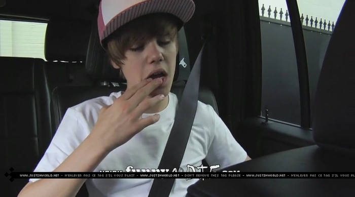 jw0139 - 0_0 Bieber After the Dentist 0_0