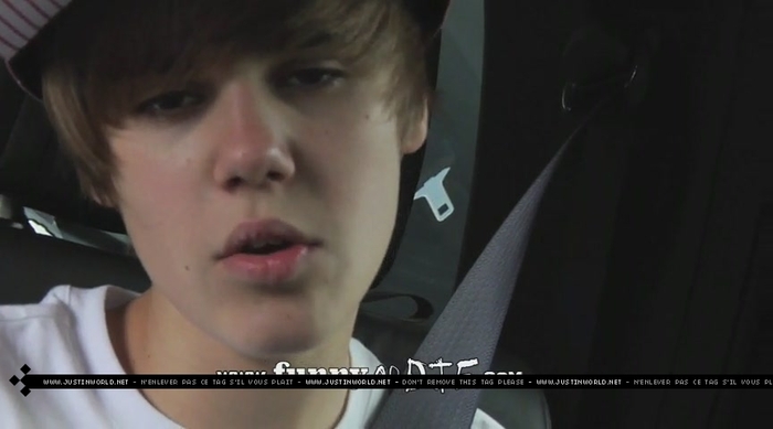 jw0157 - 0_0 Bieber After the Dentist 0_0