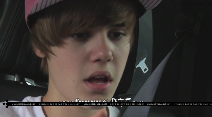 jw0167 - 0_0 Bieber After the Dentist 0_0