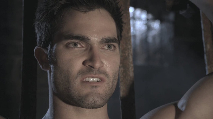 teen-wolf-1x11-Formality-tyler-hoechlin-24484354-1280-720 - xx Season 1 xx