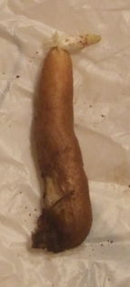 9 Tubercul inmugurit