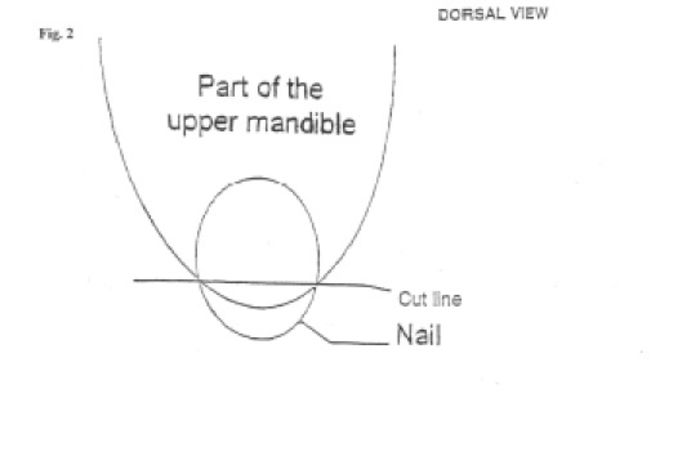 Mandibula - Rate lesesti