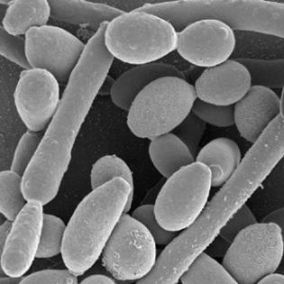 Leac contra Candida Albicans; vezi comentariul : Leac contra Candida Albicans .In poza este ciuperca Candida Albicans ,vazuta la microscop;sper sa nu mai fie raportata poza,pe motiv pudic... :)
