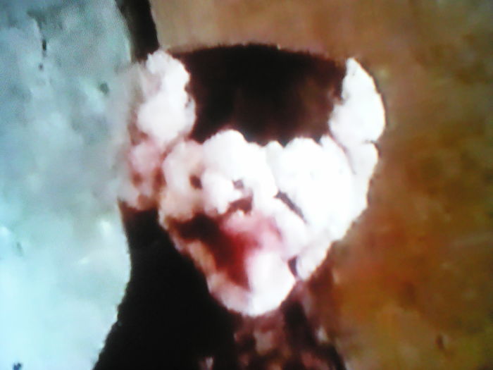 cap de CARUNCULAT  POLONEZ