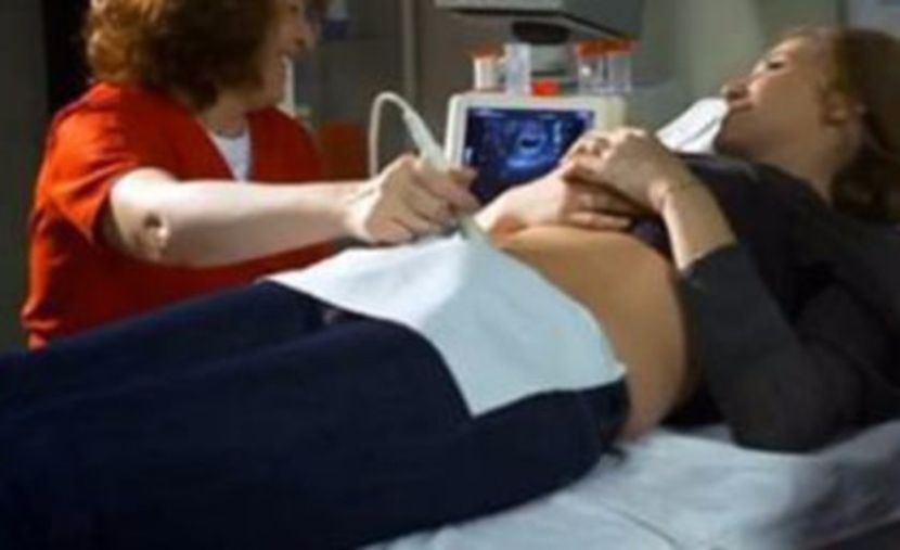102313697_SYKKPLR3 - 01b impr - pmv