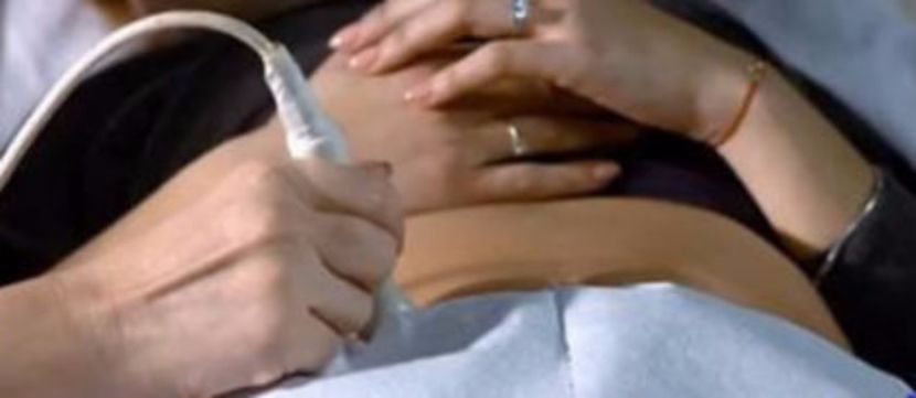 102313694_UFEGKCM - 0 a album PCV ONV pmv