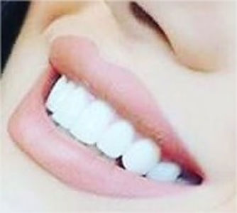  - 0 a poze care imi vor trebui - imp - 01