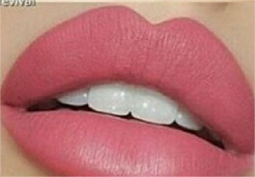  - 0 a poze care imi vor trebui - imp - 02