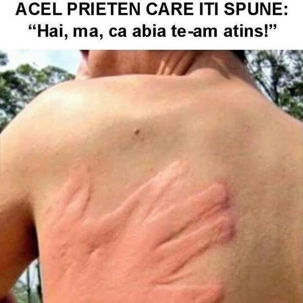  - Poze 1