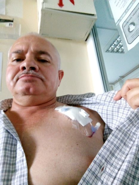 Cameră Cateter - Fotografii