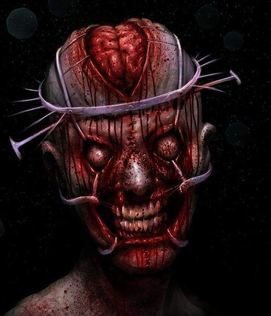  - Surgery