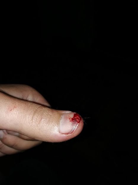  - B-Demolarea Vechilor Volerii si Construirea Celor Noi