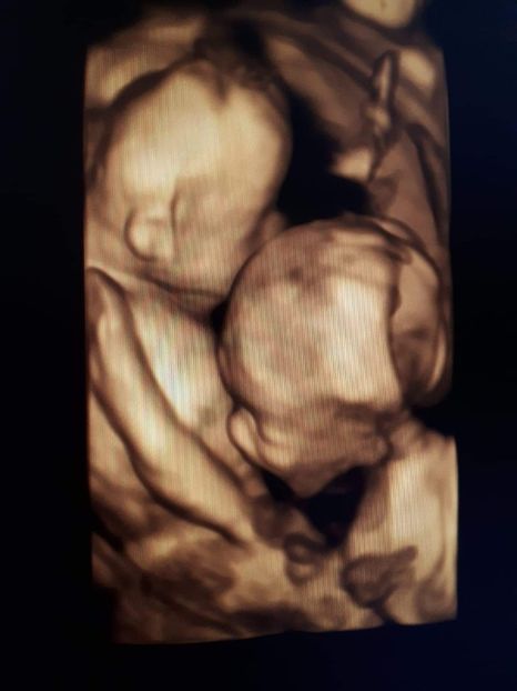 IMG-20190307-WA0006 - Gemenei