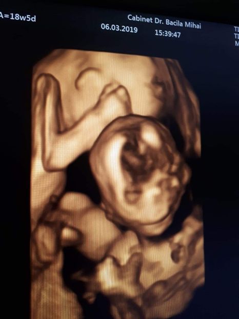 IMG-20190307-WA0002 - Gemenei