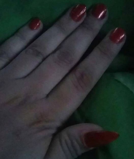  - - O - Fotografii x