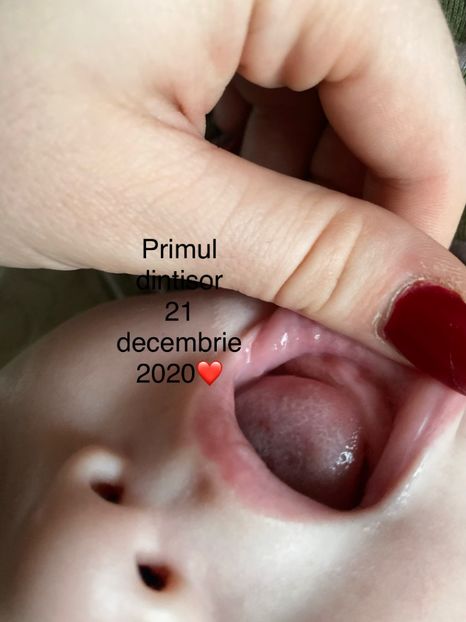 D54A787C-47E6-4DAD-9999-CBDDBD890CDB - Lucas 10 lunite