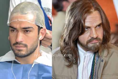 poncho-camaleones0