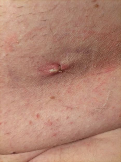 Imagine WhatsApp 2024-04-06 la 20.39.34_0f64f939 - 2023 mart-april Operatie cu Robotul DA VINCII