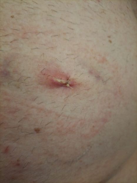 Imagine WhatsApp 2024-04-07 la 15.17.38_3fd83691 - 2023 mart-april Operatie cu Robotul DA VINCII