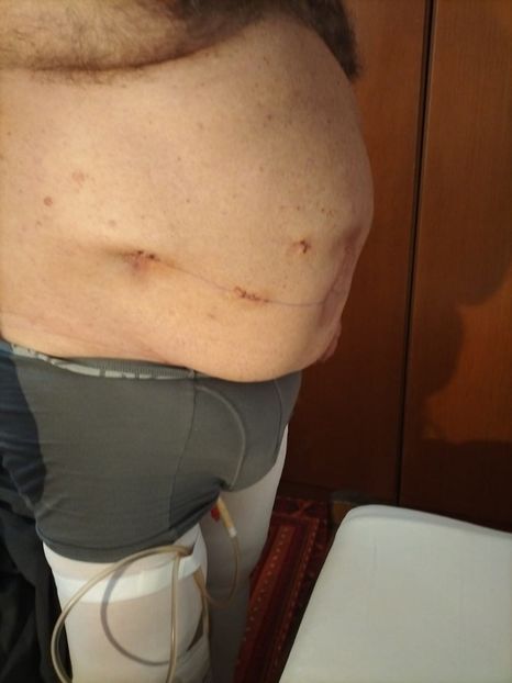 Imagine WhatsApp 2024-03-30 la 16.32.24_be783dbf - 2024 Operatie cu Robotul DA VINCII mart-april