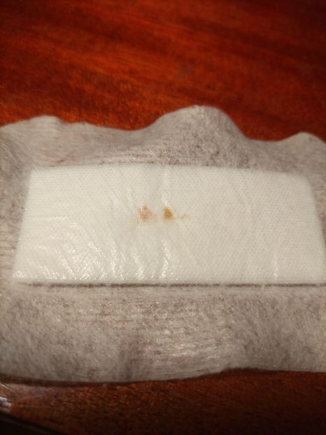 Imagine WhatsApp 2024-04-06 la 20.36.30_987ffc62 - 2024 Operatie cu Robotul DA VINCII mart-april