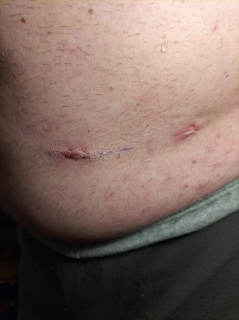 Imagine WhatsApp 2024-04-05 la 19.58.27_dfeaad60 - 2024 Operatie cu Robotul DA VINCII mart-april