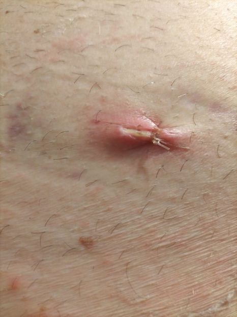 Imagine WhatsApp 2024-04-06 la 20.58.46_e8e4219c - 2024 Operatie cu Robotul DA VINCII mart-april