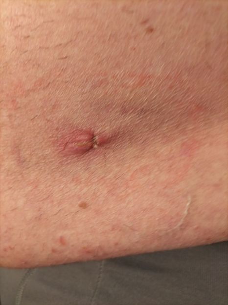 Imagine WhatsApp 2024-04-07 la 17.43.36_7154d83c - 2024 Operatie cu Robotul DA VINCII mart-april