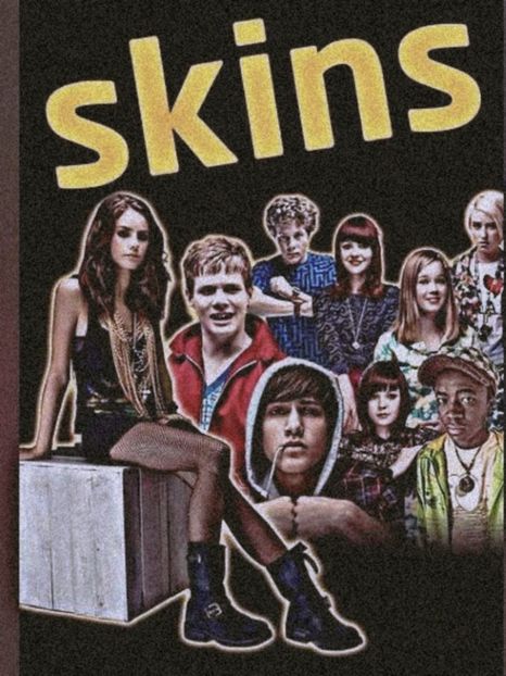 #LizGillies ↳ Skins. - Maybe its a blessing in disguise