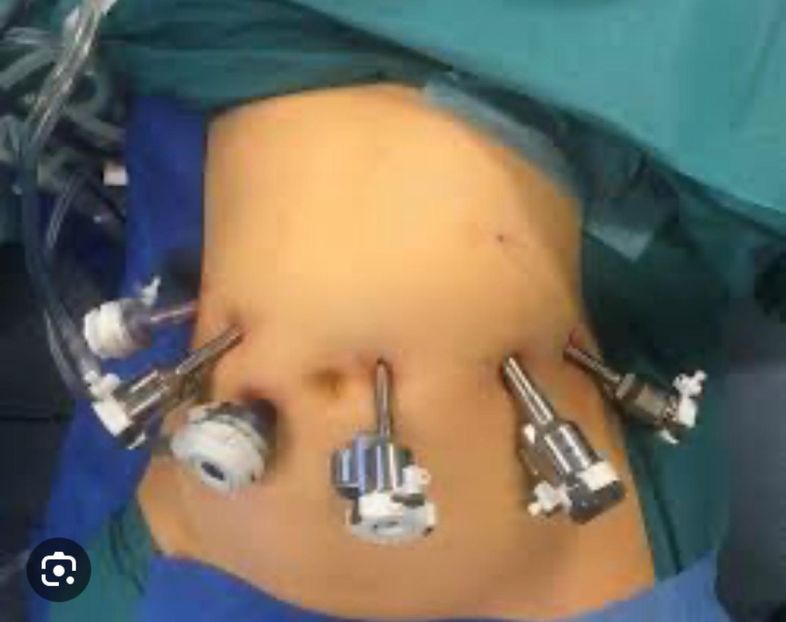 Imagine WhatsApp 2024-02-13 la 11.23.40_38527bc6 - 2024 AUREL OPERATmart30-april4