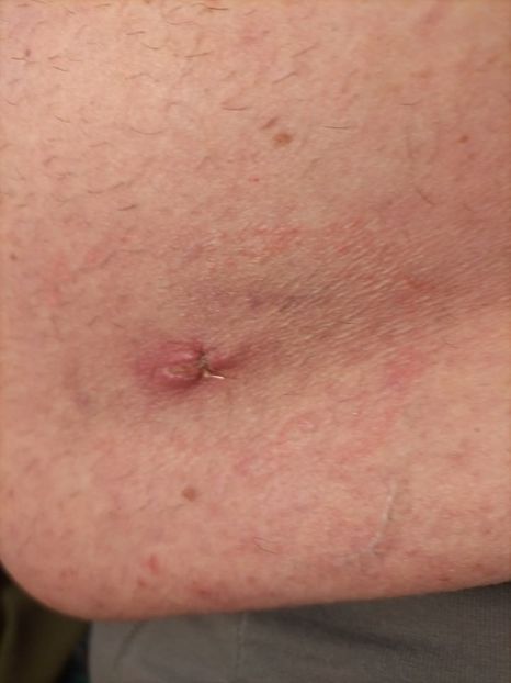 Imagine WhatsApp 2024-04-07 la 17.42.45_39547c16 - 2024 AUREL OPERATmart30-april4