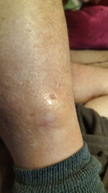 Imagine WhatsApp 2025-01-04 la 09.38.37_b24955f5 - 2025 OPERAȚIE PICIOR BUNICU 5 IAN-5 FEBR