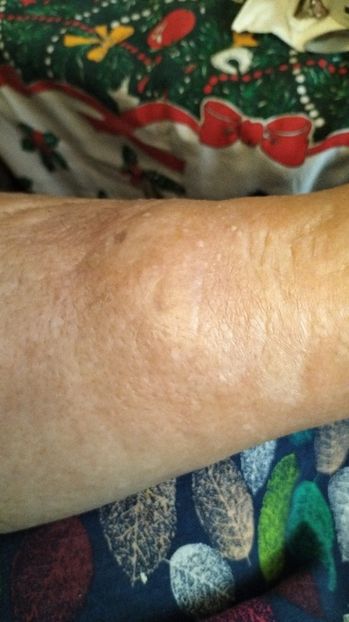 Imagine WhatsApp 2025-01-06 la 14.59.57_c19295ad - 2025 OPERAȚIE PICIOR BUNICU 5 IAN-5 FEBR