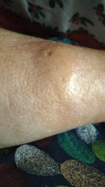 Imagine WhatsApp 2025-01-07 la 16.17.52_b0f5eaa4 - 2025 OPERAȚIE PICIOR BUNICU 5 IAN-5 FEBR