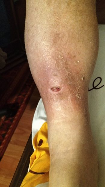 Imagine WhatsApp 2025-01-25 la 16.47.36_0f51964b - 2025 OPERAȚIE PICIOR BUNICU 5 IAN-5 FEBR