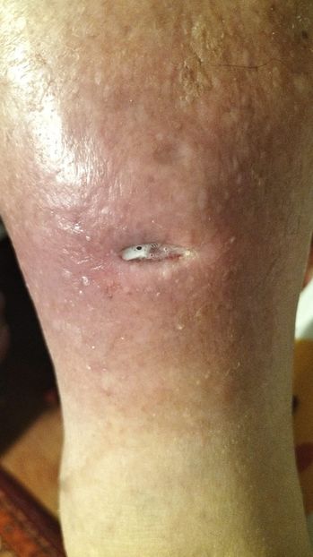 Imagine WhatsApp 2025-02-01 la 18.28.04_9d94d4bd - 2025 OPERAȚIE PICIOR BUNICU 5 IAN-5 FEBR