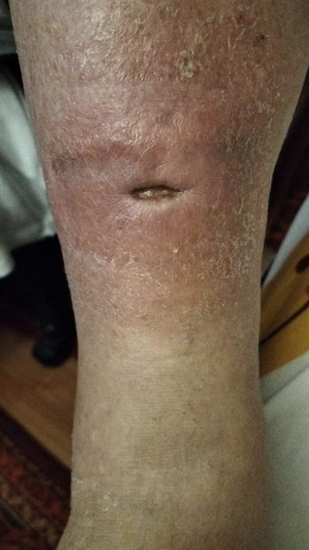 Imagine WhatsApp 2025-02-02 la 18.19.29_5efa9835 - 2025 OPERAȚIE PICIOR BUNICU 5 IAN-5 FEBR