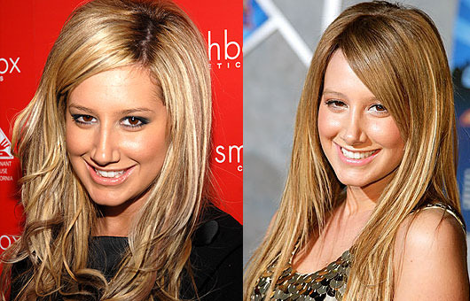 ashley-tisdale-plastic-surgery