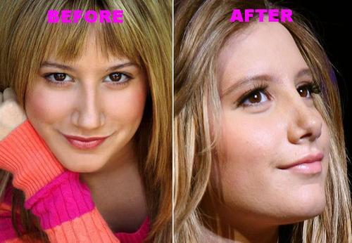 ashnose - ceva super ashley tisdale