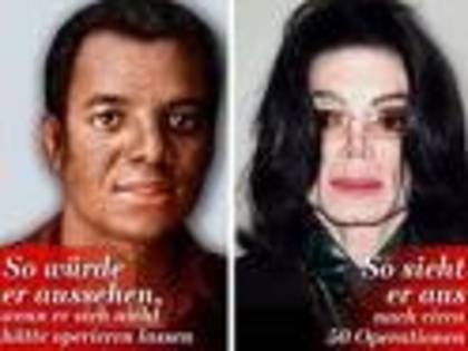 CDYXXCPQCZLQMKIOGSM[1] - Michael Jackson fara operatzii estetice