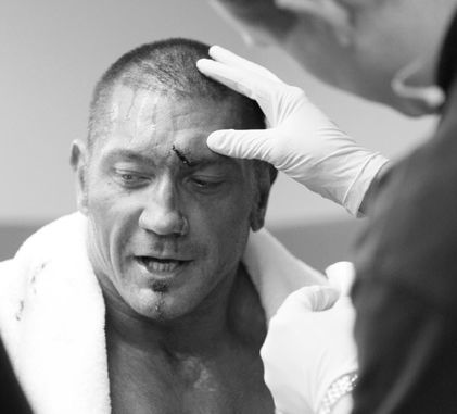 Dave-Batista-Under-Medical-Treatment