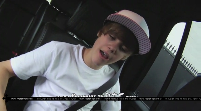 jw0007 - 0_0 Bieber After the Dentist 0_0