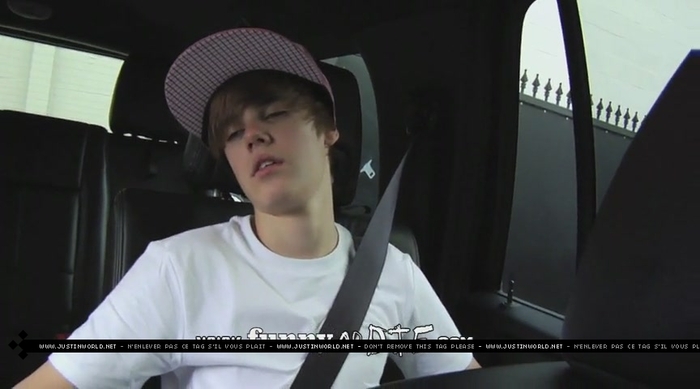 jw0026 - 0_0 Bieber After the Dentist 0_0