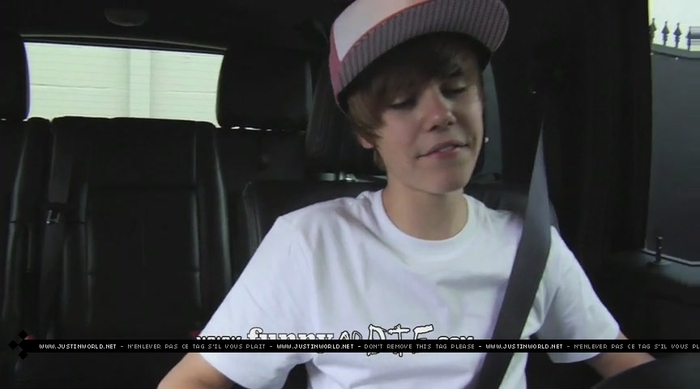 jw0034 - 0_0 Bieber After the Dentist 0_0