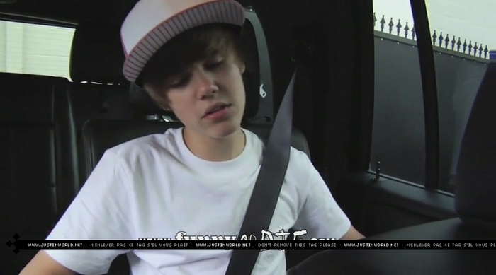 jw0054 - 0_0 Bieber After the Dentist 0_0