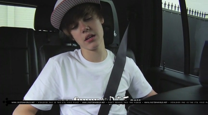 jw0058 - 0_0 Bieber After the Dentist 0_0