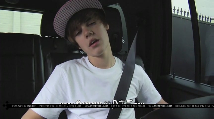 jw0061 - 0_0 Bieber After the Dentist 0_0