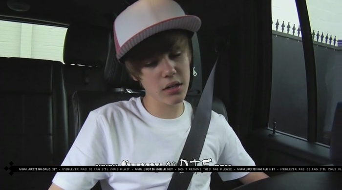 jw0100 - 0_0 Bieber After the Dentist 0_0