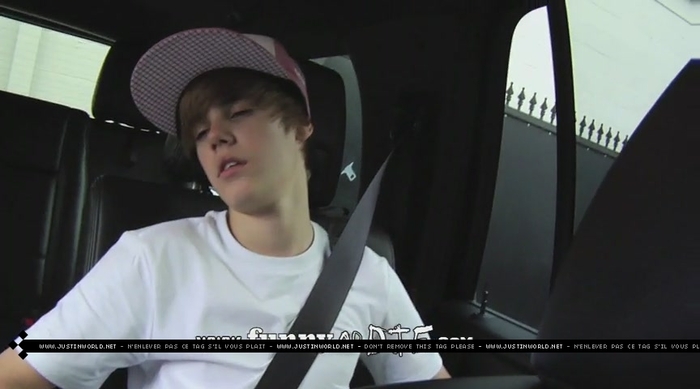 jw0102 - 0_0 Bieber After the Dentist 0_0