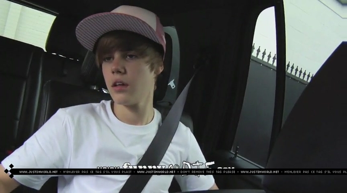 jw0105 - 0_0 Bieber After the Dentist 0_0